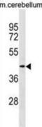 Tropomodulin 2 antibody, abx030282, Abbexa, Western Blot image 