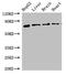 Kallikrein B1 antibody, CSB-PA012461LA01HU, Cusabio, Western Blot image 