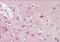 Origin Recognition Complex Subunit 3 antibody, NB100-796, Novus Biologicals, Immunohistochemistry frozen image 