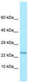 Myelin Associated Oligodendrocyte Basic Protein antibody, TA337719, Origene, Western Blot image 