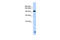 Trinucleotide Repeat Containing Adaptor 6B antibody, 25-599, ProSci, Western Blot image 