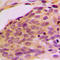 Myosin Phosphatase Rho Interacting Protein antibody, LS-C354158, Lifespan Biosciences, Immunohistochemistry paraffin image 