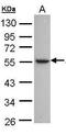 Alcohol Dehydrogenase 1C (Class I), Gamma Polypeptide antibody, PA5-27398, Invitrogen Antibodies, Western Blot image 
