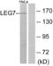 Galectin 7B antibody, LS-C119569, Lifespan Biosciences, Western Blot image 