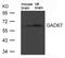 Glutamate Decarboxylase 1 antibody, 79-726, ProSci, Western Blot image 