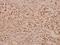 c-Myc antibody, A00026, Boster Biological Technology, Immunohistochemistry paraffin image 