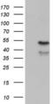 Ectonucleoside Triphosphate Diphosphohydrolase 1 antibody, LS-C339245, Lifespan Biosciences, Western Blot image 