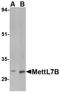 Methyltransferase Like 7B antibody, NBP1-76958, Novus Biologicals, Western Blot image 