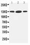 Histone Deacetylase 6 antibody, LS-C312754, Lifespan Biosciences, Western Blot image 