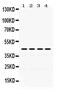 Actin Alpha 1, Skeletal Muscle antibody, PA5-78715, Invitrogen Antibodies, Western Blot image 