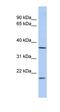 Methylenetetrahydrofolate Dehydrogenase (NADP+ Dependent) 2 Like antibody, orb330828, Biorbyt, Western Blot image 