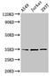 MAGE Family Member A3 antibody, CSB-PA013329LA01HU, Cusabio, Western Blot image 