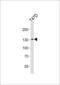 ATPase Family AAA Domain Containing 2 antibody, 56-834, ProSci, Western Blot image 