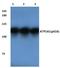 ATPase Na+/K+ Transporting Subunit Alpha 1 antibody, A00956S16, Boster Biological Technology, Western Blot image 