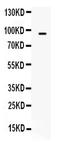 Y1 antibody, PB9824, Boster Biological Technology, Western Blot image 