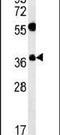 Tetraspanin 3 antibody, PA5-25472, Invitrogen Antibodies, Western Blot image 