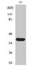 Matrix metalloproteinase-23 antibody, STJ90063, St John