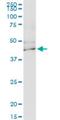 Potassium Voltage-Gated Channel Subfamily J Member 15 antibody, H00003772-M13, Novus Biologicals, Western Blot image 