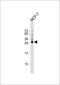 ER Membrane Protein Complex Subunit 3 antibody, 62-047, ProSci, Western Blot image 
