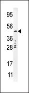 Plasminogen Activator, Urokinase antibody, PA5-15487, Invitrogen Antibodies, Western Blot image 