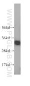 GTPase, IMAP Family Member 7 antibody, 17293-1-AP, Proteintech Group, Western Blot image 