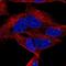 Distal-Less Homeobox 6 antibody, NBP2-56915, Novus Biologicals, Immunocytochemistry image 