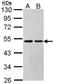 Argininosuccinate Lyase antibody, PA5-22300, Invitrogen Antibodies, Western Blot image 