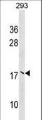 Ubiquitin Conjugating Enzyme E2 V2 antibody, LS-C157313, Lifespan Biosciences, Western Blot image 