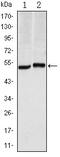 Carbonic Anhydrase 9 antibody, ab107257, Abcam, Western Blot image 