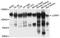 Lon Peptidase 1, Mitochondrial antibody, A4293, ABclonal Technology, Western Blot image 