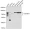 UDP Glucuronosyltransferase Family 2 Member B10 antibody, GTX64878, GeneTex, Western Blot image 