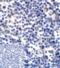 CD276 Molecule antibody, RF16091, ProSci Inc, Immunohistochemistry frozen image 
