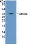 Tyrosine Kinase 2 antibody, abx128149, Abbexa, Western Blot image 