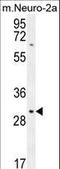 Transmembrane Protein 65 antibody, LS-C162019, Lifespan Biosciences, Western Blot image 