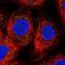 Myomesin 3 antibody, NBP1-81960, Novus Biologicals, Immunocytochemistry image 