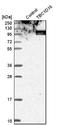 TBC1 Domain Family Member 16 antibody, NBP1-83635, Novus Biologicals, Western Blot image 