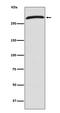 Chromodomain Helicase DNA Binding Protein 4 antibody, M01125, Boster Biological Technology, Western Blot image 