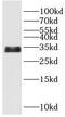 Pyp antibody, FNab06656, FineTest, Western Blot image 