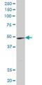 YTH N6-Methyladenosine RNA Binding Protein 2 antibody, H00051441-B01P, Novus Biologicals, Western Blot image 