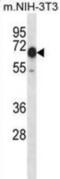 Calcium/Calmodulin Dependent Protein Kinase Kinase 2 antibody, abx028441, Abbexa, Western Blot image 