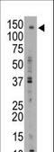 ATP Binding Cassette Subfamily B Member 11 antibody, LS-C100358, Lifespan Biosciences, Western Blot image 