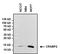 Cellular Retinoic Acid Binding Protein 2 antibody, MA3-017, Invitrogen Antibodies, Western Blot image 