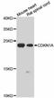 p21 antibody, STJ23069, St John