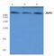 APC Regulator Of WNT Signaling Pathway antibody, NB100-91662, Novus Biologicals, Western Blot image 