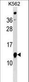 ATP Synthase Inhibitory Factor Subunit 1 antibody, LS-C159142, Lifespan Biosciences, Western Blot image 