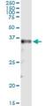 Msh Homeobox 2 antibody, H00004488-M10, Novus Biologicals, Immunoprecipitation image 