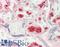 Hemoglobin Subunit Gamma 1 antibody, LS-B13808, Lifespan Biosciences, Immunohistochemistry paraffin image 