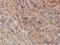 G3BP Stress Granule Assembly Factor 1 antibody, H00010146-M01, Novus Biologicals, Immunohistochemistry paraffin image 