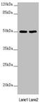 Solute Carrier Family 39 Member 7 antibody, LS-C676514, Lifespan Biosciences, Western Blot image 