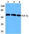 Chaperonin Containing TCP1 Subunit 6A antibody, A09373-2, Boster Biological Technology, Western Blot image 